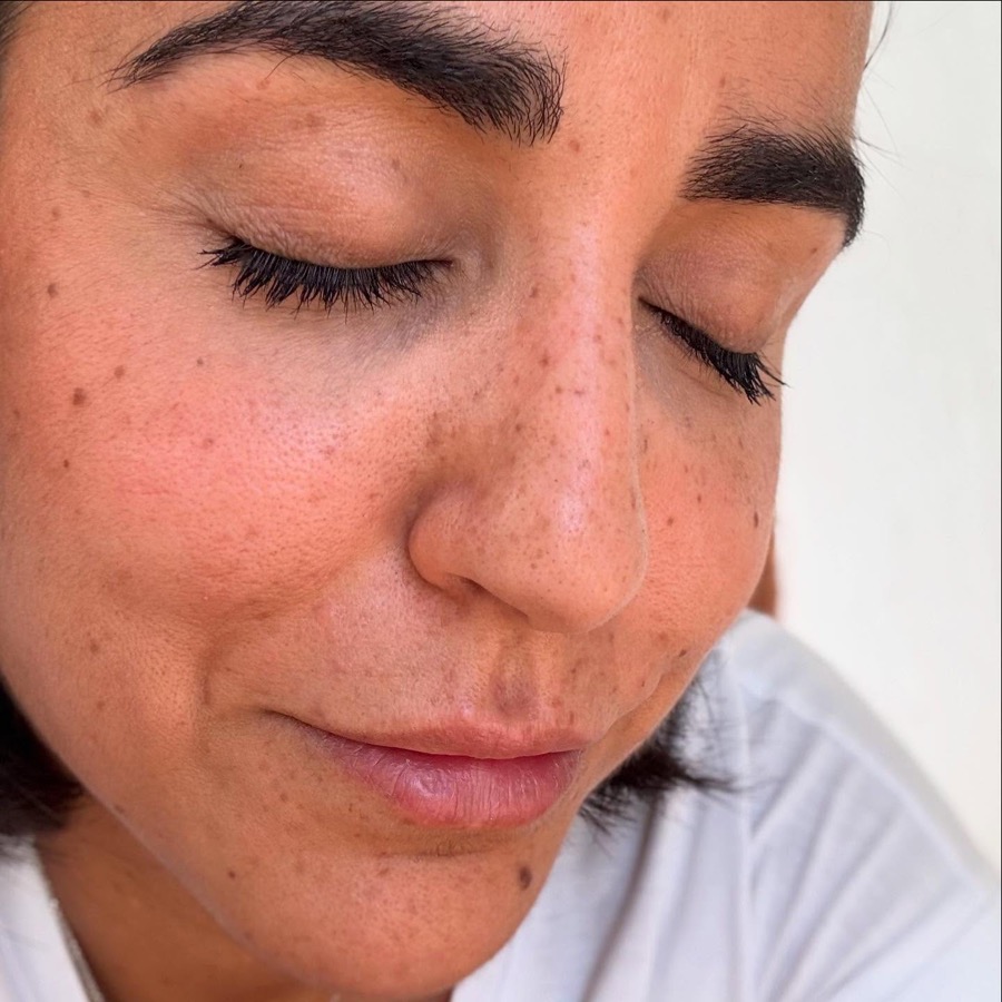 Visage d'une cliente aux yeux fermés avec des taches de rousseurs dessinées